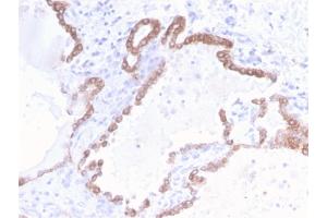 Immunohistochemistry (IHC) image for anti-Keratin 18 (KRT18) antibody (ABIN6939938)