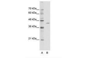 Image no. 1 for anti-Zinc Finger and BTB Domain Containing 26 (ZBTB26) (AA 181-230) antibody (ABIN6736113) (ZBTB26 抗体  (AA 181-230))