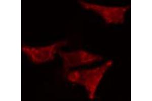 ABIN6266802 staining HeLa cells by IF/ICC. (EPS8-Like 2 抗体  (N-Term))