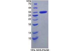 SDS-PAGE analysis of Human CA5B Protein. (CA5B 蛋白)