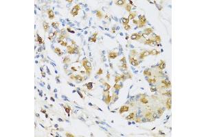 Immunohistochemistry of paraffin-embedded human stomach using RNASE3 antibody (ABIN5974969) at dilution of 1/100 (40x lens). (RNASE3 抗体)