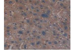Detection of MPP6 in Human Liver Tissue using Polyclonal Antibody to Membrane Protein, Palmitoylated 6 (MPP6)