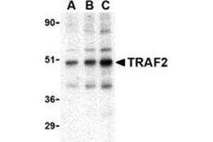 Western blot analysis of TRAF2 in mouse liver tissue lysate with this product at (A) 0. (TRAF2 抗体  (C-Term))
