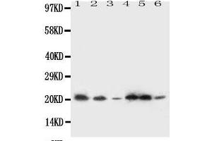 Western Blotting (WB) image for anti-Signal Sequence Receptor gamma (SSRg) (AA 8-23), (N-Term) antibody (ABIN3044181)