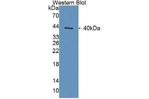 Western blot analysis of the recombinant protein. (TAP1 抗体  (AA 525-808))