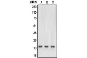 Western blot analysis of NRAS/HRAS/KRAS expression in HEK293T (A), HeLa (B), mouse brain (C), rat heart (D) whole cell lysates. (NRAS/HRAS/KRAS 抗体  (N-Term))