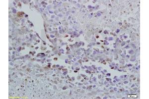 Formalin-fixed and paraffin embedded mouse lymphoma labeled with Anti-Oct-3/Oct-4 Polyclonal Antibody, Unconjugated (ABIN737826) at 1:200 followed by conjugation to the secondary antibody and DAB staining. (OCT4 抗体  (AA 201-300))