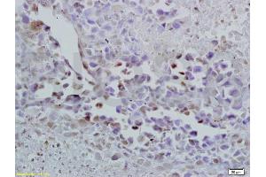 Formalin-fixed and paraffin embedded mouse lymphoma labeled with Anti-Oct-3/Oct-4 Polyclonal Antibody, Unconjugated (ABIN737826) at 1:200 followed by conjugation to the secondary antibody and DAB staining. (OCT4 抗体  (AA 201-300))