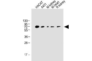 All lanes : Anti-OTOP1 Antibody (Center) at 1:1000 dilution Lane 1: HACAT whole cell lysate Lane 2: A431 whole tissue lysate Lane 3: Mouse kidney whole tissue lysate Lane 4: Mouse heart whole tissue lysate Lane 5: Rat kidney whole cell lysate Lane Lysates/proteins at 20 μg per lane. (Otopetrin 1 抗体  (AA 360-388))
