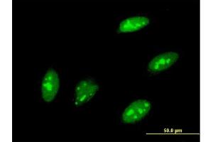 Immunofluorescence of monoclonal antibody to TEAD3 on HeLa cell. (TEAD3 抗体  (AA 215-302))