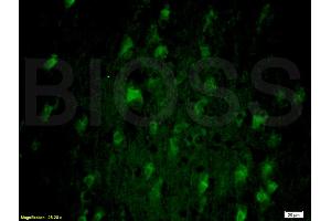 Formalin-fixed and paraffin-embedded rat brain labeled with Anti-SNAP25 Polyclonal Antibody, Unconjugated (ABIN738111) 1:200, overnight at 4°C, The secondary antibody was Goat Anti-Rabbit IgG, FiTC conjugated used at 1:200 dilution for 40 minutes at 37°C. (SNAP25 抗体  (AA 166-206))