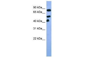 WB Suggested Anti-Arnt Antibody Titration:  0. (ARNT 抗体  (C-Term))