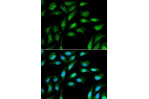 Immunofluorescence analysis of MCF-7 cells using B2M antibody. (beta-2 Microglobulin 抗体  (AA 21-119))
