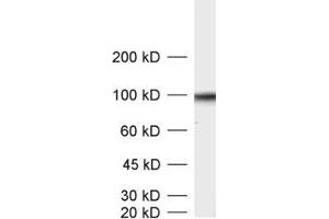 dilution: 1 : 1000, sample: crude synaptic vesicle fraction of rat brain (LP2) (SV2B 抗体  (AA 2-17))