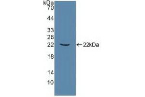 Detection of Recombinant ATP1a1, Human using Polyclonal Antibody to ATPase, Na+/K+ Transporting Alpha 1 Polypeptide (ATP1a1) (ATP1A1 抗体  (AA 493-660))
