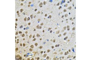 Immunohistochemistry of paraffin-embedded rat brain using PPID Antibody (ABIN5974177) at dilution of 1/100 (40x lens). (PPID 抗体)