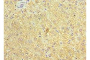 Immunohistochemistry of paraffin-embedded human liver tissue using ABIN7148555 at dilution of 1:100 (ATP7B 抗体  (AA 1166-1465))