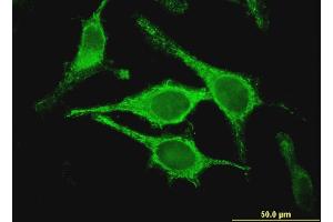 Immunofluorescence of monoclonal antibody to CLIC5 on HeLa cell. (CLIC5 抗体  (AA 91-190))