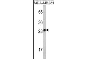 Western blot analysis of IL2 Antibody (Center) (ABIN390899 and ABIN2841106) in MDA-M cell line lysates (35 μg/lane). (IL-2 抗体  (AA 50-77))
