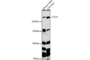 Western blot analysis of extracts of various cell lines, using TET2 antibody (ABIN6133019, ABIN6149017, ABIN6149019 and ABIN6221336) at 1:1000 dilution. (TET2 抗体  (AA 1833-2002))