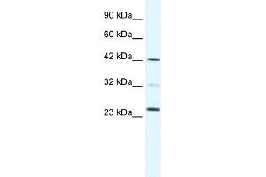 WB Suggested Anti-E2F1 Antibody Titration:  0. (E2F1 抗体  (C-Term))