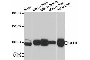 Western blot analysis of extracts of various cell lines, using XPOT antibody. (XPOT 抗体  (AA 1-200))