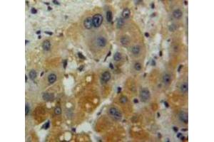 Used in DAB staining on fromalin fixed paraffin-embedded Liver tissue (IL-10 抗体  (AA 1-178))