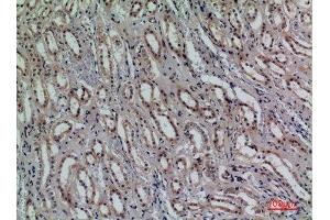 Immunohistochemistry (IHC) analysis of paraffin-embedded Human Kidney, antibody was diluted at 1:100. (CD159a/c (Internal Region) 抗体)
