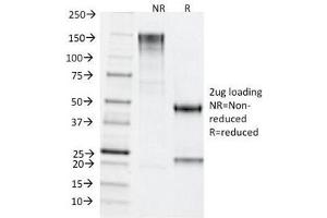 SDS-PAGE Analysis of Purified, BSA-Free TDP2 Antibody (clone TDP2/1258). (TDP2 抗体)