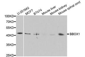 Western blot analysis of extracts of various cell lines, using BBOX1 antibody. (BBOX1 抗体  (AA 1-180))