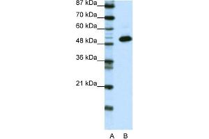 WB Suggested Anti-TADA3L Antibody Titration:  0. (TADA3L 抗体  (N-Term))