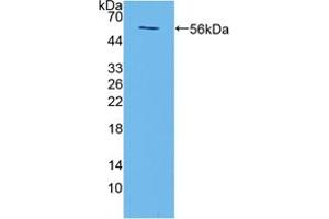 Western blot analysis of recombinant Mouse TMEM27. (TMEM27 抗体  (AA 12-222))