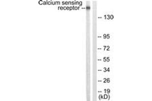 Western blot analysis of extracts from LOVO cells, using Calcium Sensing Receptor (Ab-888) Antibody. (CASR 抗体  (AA 854-903))