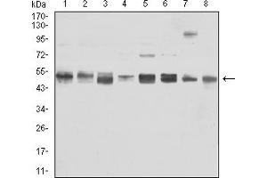 Western Blotting (WB) image for anti-Vimentin (VIM) (AA 2-466) antibody (ABIN7193582)