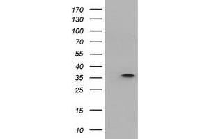 Western Blotting (WB) image for anti-Deoxynucleotidyltransferase, Terminal, Interacting Protein 1 (DNTTIP1) antibody (ABIN1497876) (DNTTIP1 抗体)