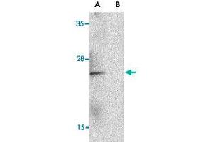 Western blot analysis of IL23A in Raji lysate with IL23A polyclonal antibody  at 1 ug/mL in the (A) absence and (B) presence of blocking peptide. (IL23A 抗体  (C-Term))