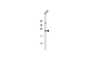 Western blot analysis of anti-Bad Antibody (Center) (ABIN388109 and ABIN2846236) in HL60 cell line lysates (35 μg/lane). (BAD 抗体  (AA 53-81))