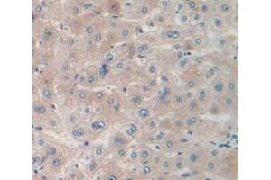 IHC-P analysis of Human Tissue, with DAB staining. (MPST 抗体  (AA 68-278))