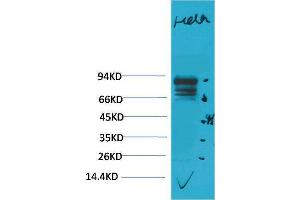 Western Blotting (WB) image for anti-Signal Transducer and Activator of Transcription 3 (Acute-Phase Response Factor) (STAT3) antibody (ABIN3188048)