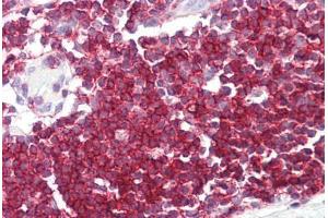 Image no. 2 for anti-Septin 9 (SEPT9) (C-Term) antibody (ABIN6749752) (Septin 9 抗体  (C-Term))