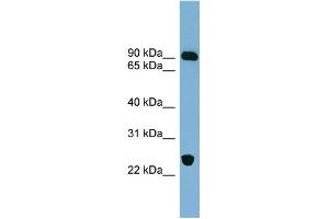 WB Suggested Anti-VPS53 Antibody Titration: 0. (VPS53 抗体  (Middle Region))