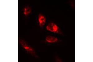 Immunofluorescent analysis of OCT2 staining in HeLa cells. (Oct-2 抗体  (N-Term))
