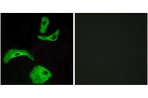 Immunofluorescence analysis of HeLa cells, using GPR18 Antibody. (GPR18 抗体  (AA 131-180))