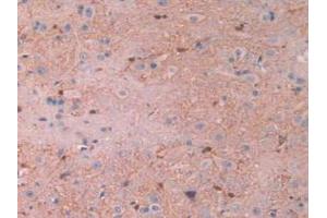 IHC-P analysis of Rat Spinal Cord Tissue, with DAB staining. (CAPNL1 抗体  (AA 387-694))