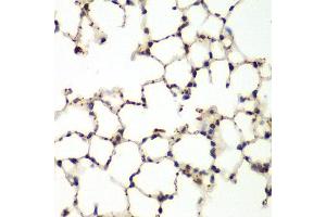 Immunohistochemistry of paraffin-embedded mouse lung using MAPK9 antibody at dilution of 1:200 (400x lens). (JNK2 抗体)