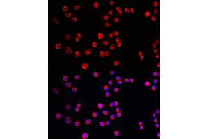 Immunofluorescence analysis of Neuro-2a cells using PTPN5 Rabbit pAb (ABIN7269705) at dilution of 1:150 (40x lens). (PTPN5 抗体  (AA 360-490))