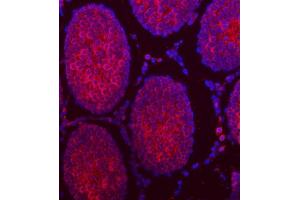 IF analysis of TTLL2 using anti-TTLL2 antibody (ABIN7600850).