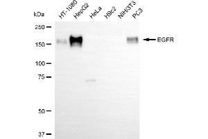 Western blotting analysis using EGFR antibody (ABIN7798460). (EGFR 抗体)