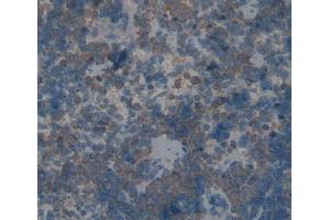 IHC-P analysis of spleen tissue, with DAB staining. (TLR1 抗体  (AA 25-134))