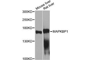 Western blot analysis of extracts of various cell lines, using MAPKBP1 antibody (ABIN5971432) at 1/1000 dilution. (MAPKBP1 抗体)